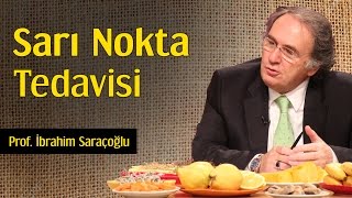 Sarı Nokta Tedavisi  Prof İbrahim Saraçoğlu [upl. by Ilaw]