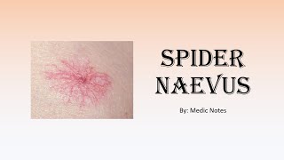 Spider naevus  causes pathophysiology sign value [upl. by Augustina94]