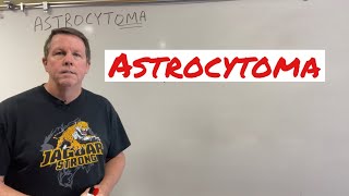 Astrocytomas Brain Tumors Explained [upl. by Noivert]