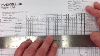 Blood Bank  Antibody Identification I [upl. by Arim682]