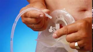 How to connect a urostomy pouch to night drainage bag [upl. by Bonita]