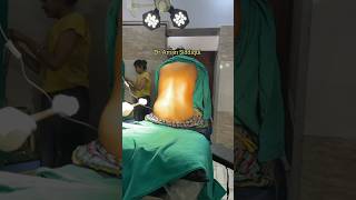 Spinal Anesthesia  How to give Spinal Anesthesia  Dr Aman Siddiqui  anaesthesia  spinal [upl. by Vasileior]