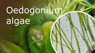 Oedogonium Algae Under a Microscope 100x1000x [upl. by Mcarthur]