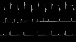 Orcan  “Promotion” C64 Oscilloscope View [upl. by Eeram219]