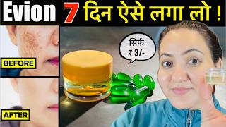 3 रूपए की चीज़ से पाए गोरी निखरी Skin हमेशा के लिए Vitamin E se झाइयाँ Open Pores Pigmentation गायब💕 [upl. by Alleyne]