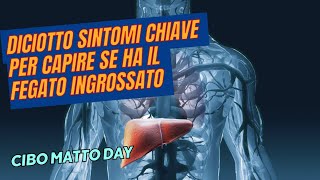 18 Sintomi di Ingrossamento del Fegato Come Identificarli e Prevenirli [upl. by Eatnom]