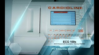 ECG 100s  CARDIOLINE [upl. by Macfarlane]