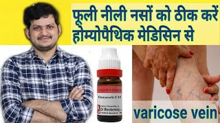 Powerful Homeopathic Medicine for Varicose veins [upl. by Digirb]