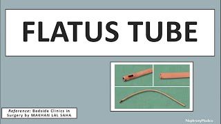 Flatus Tube  Surgical Instruments  Rapid Revision  OSPE  SURGERY [upl. by Edualcnaej569]