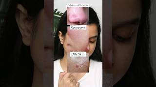 The Ordinary Niacinamide Vs Salicylic Acid Serum For Sebaceous Filament Open Pores amp Oily Skin [upl. by Kall]