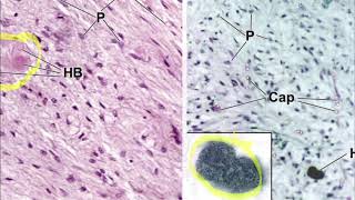 HISTOLOGÍA DEL SISTEMA ENDOCRINO  Neurohipófisis Oxitocina y Antidiurética [upl. by Nalyr695]