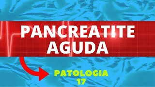 PANCREATITE AGUDA  CARACTERÍSTICAS DIAGNÓSTICO E TRATAMENTO [upl. by Nnyleimaj382]