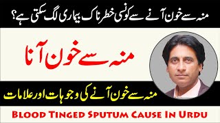 Moun se khoon ana  Khoon Thukna  Blood Tinged Sputum Cause In Urdu Dr Jahangir Yasir [upl. by Noied]