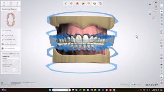 Ivotion Monolithic Denture Design [upl. by Mayrim]