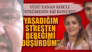 HİKAYE YÜZÜ KAYNAK YAPARKEN YANAN KHK’LI ÜSTEĞMENİN EŞİ “YAŞADIĞIM STRESTEN BEBEĞİMİ DÜŞÜRDÜM” [upl. by Neehar]