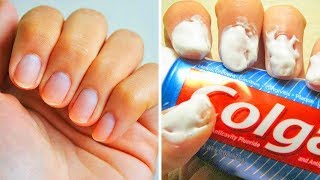 20 einfache Tricks für perfekte Fingernägel [upl. by Kramer]