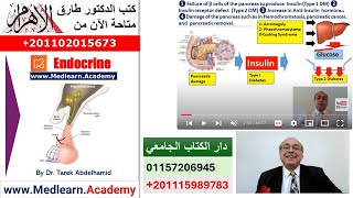 Diabetes Mellitus 1 Introduction cme internalmedicine medical usmle محاضراتباطنة [upl. by Aryn]