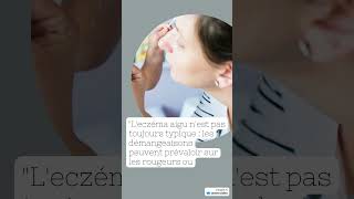 ECZEMA solution contre les eczemas ou exema [upl. by Sneed313]