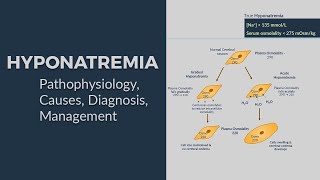 Hyponatremia  Pathophysiology Causes Diagnostic Approach amp Management 😊 AllinOne Package 😊 [upl. by Afas]