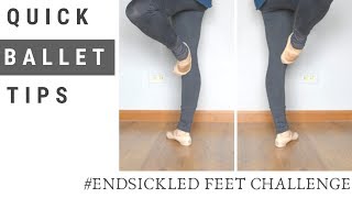 Preventing Sickled Feet in Retiré  Endsickledfeet Challenge [upl. by Elbon]