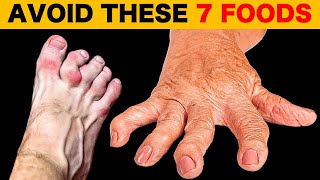 7 Foods To Avoid If You Have Arthritis [upl. by Amick930]