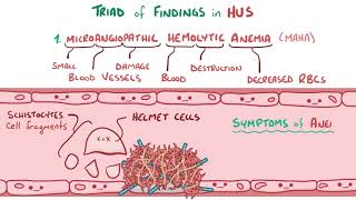 Hemolytic uremic syndrome [upl. by Glad168]