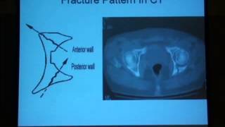 12 Radiological diagnosis of the acetabulum H Abdel Azeem [upl. by Elleda238]