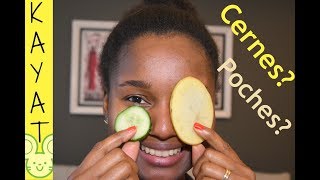 👍😀 VOILA DES ASTUCES EFFICACES POUR SE DEBARASSER DES CERNES ET POCHES SOUS LES YEUX  KAYATOO [upl. by Ayotas225]