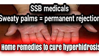 How to cure sweaty palms  Hyperhidrosis  SSB medicals [upl. by Eiramlatsyrk820]