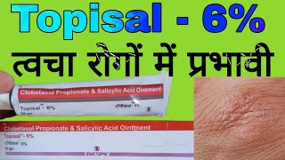 Topisal  6 Uses in Hindi  Clobetasol Propionate and Salicylic Acid Ointment [upl. by Giamo]