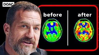 How to MASTER Your DOPAMINE and TAKE CONTROL of Your LIFE  Andrew Huberman [upl. by Ahsimot840]