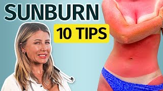 How to clear dark sunburn naturally fast [upl. by Ax]