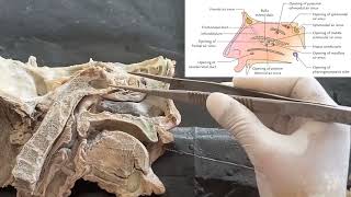 Dissection of lateral wall of nasal cavity  Anatomy of meatus and concha  structures within meatus [upl. by Undis311]