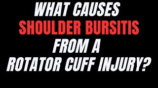 What Causes Shoulder Bursitis From A Rotator Cuff Injury [upl. by Akim954]