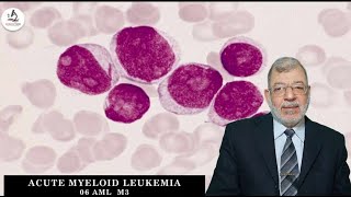 Acute Myeloid Leukemia 06 M3 [upl. by Sewel]