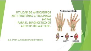 ANTICUERPOS ANTIPROTEÍNAS CITRULINADA [upl. by Leonard]