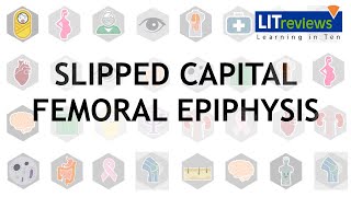 Slipped Capital Femoral Epiphysis [upl. by Bil216]