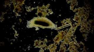 🔬 Bärtierchen  Tardigrada  Tardigrade  waterbears  moss piglets microorganism under microscope [upl. by Sitarski]