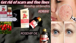 Rosehip oil for acne scars And fine lines Rosehip oil by Hemani Review [upl. by Ahsiekram]