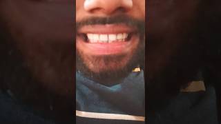 FRUIT STRIPE GUM ASMR brushyourteeth [upl. by Stevy]