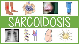 Sarcoidosis in 3 Minutes [upl. by Bach]