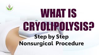 What is Cryolipolysis Nonsurgical Live Procedure of Cryolipolysis Treatment amp Facts CoolSculpting [upl. by Aisat]