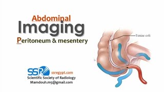 14 Imaging of peritonium and mesentery TEC Prof Mamdouh Mahfouz [upl. by Luahs]