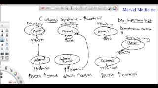 Cushings syndrome and the Dexamethasone suppression test [upl. by Gorton264]