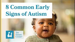 8 Common Early Signs of Autism [upl. by Ynitsed812]