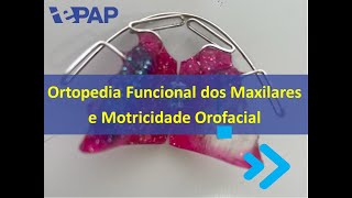 Ortopedia Funcional dos Maxilares [upl. by Leumek]