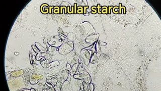 Granular starch in Stool sample stooltest stoolanalysis stoolexamination فحص الخروج [upl. by Sig]