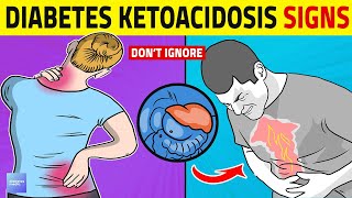 Diabetic Ketoacidosis Warning Signs You Should Know [upl. by Ivor873]