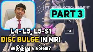 L4L5 and L5S1 Disc Bulge in MRI Whats Next Part 2 with Dr Vijayaraghavan in Tamil [upl. by Gav980]