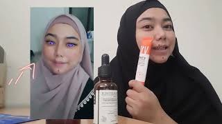 REVIEW SOME BY MI GALACTOMYCES PURE VITAMIN C NGILANGIN FLEK HITAM [upl. by Naga5]